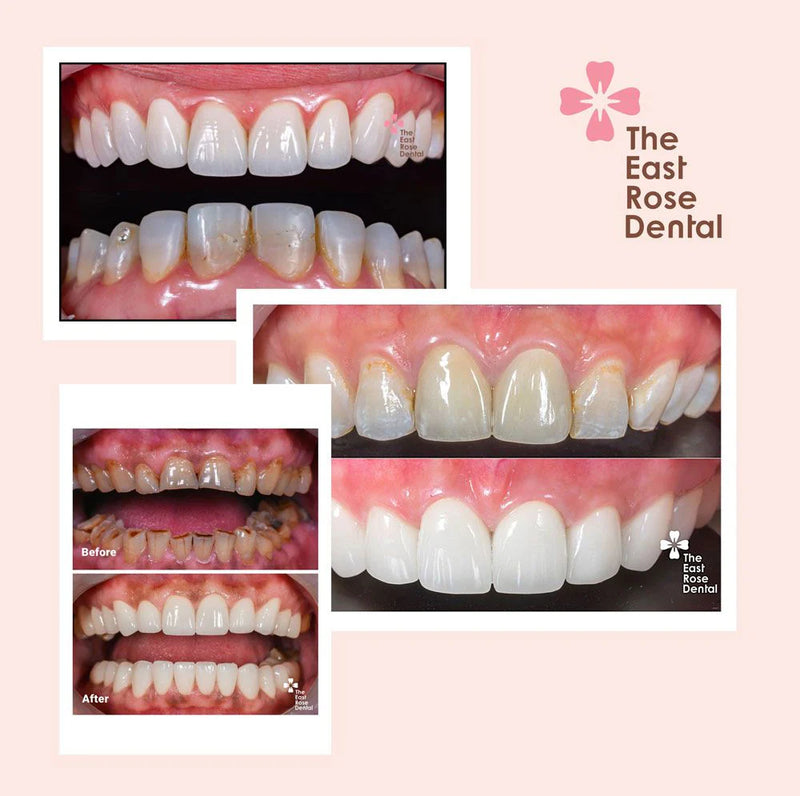 The East Rose Dental